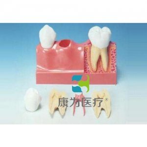 “康為醫(yī)療”牙分解模型（4倍大）
