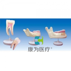“康為醫(yī)療”磨牙、乳牙、橫牙解剖(自然大)