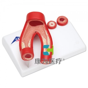 動脈硬化模型，帶動脈切面，2部分