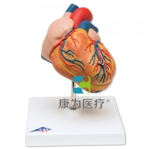 經(jīng)典心臟模型，呈左心室肥大，2部分