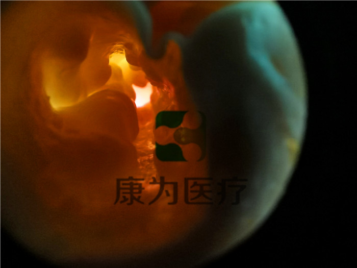 基礎款上部消化道內視鏡訓練模擬器.jpg