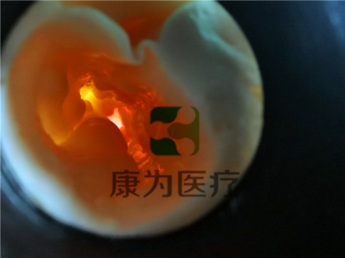 基礎款上部消化道內視鏡訓練模擬器.jpg